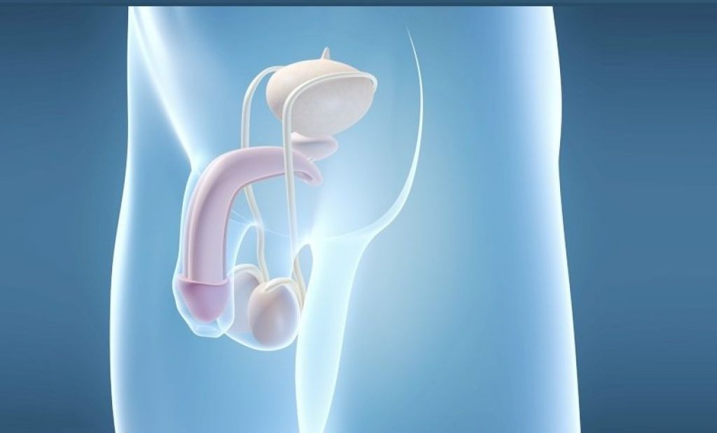 Die Prothesenimplantation ist eine chirurgische Methode zur Vergrößerung des männlichen Penis. 